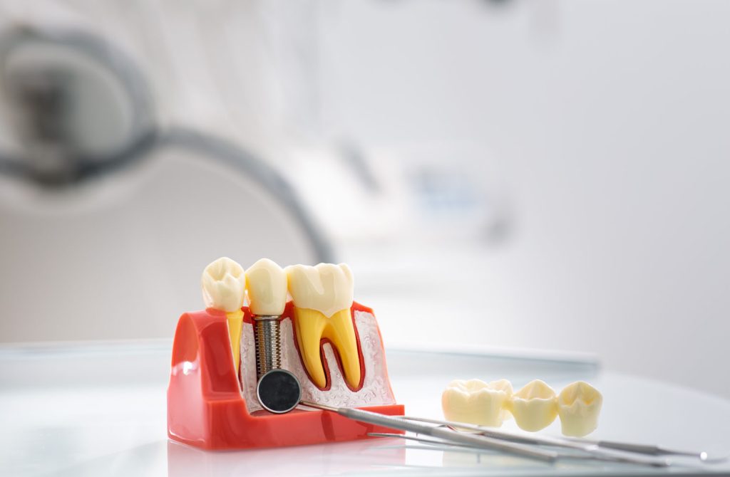 detailed tooth model showcases the layers of ename 2026 03 20 04 12 12 utc