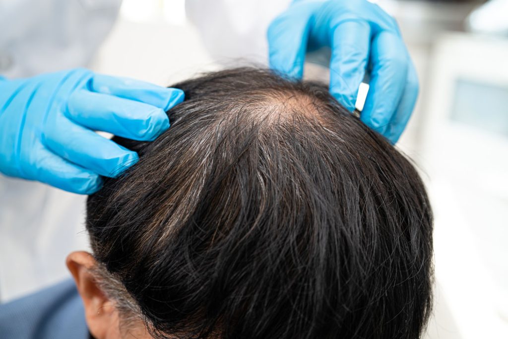 doctor checkup and treatment asian man baldness ha 2026 03 19 07 07 21 utc
