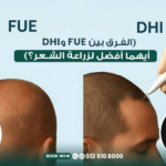 الفرق بين زراعة الشعر بتقنية FUE وDHI