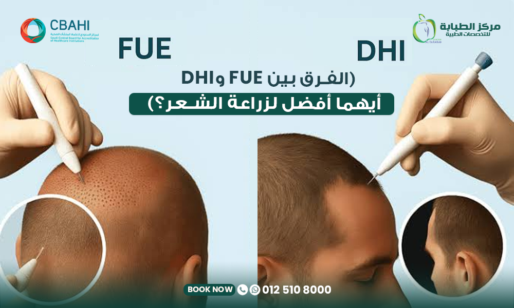 الفرق بين زراعة الشعر بتقنية FUE وDHI
