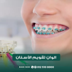 ألوان تقويم الأسنان