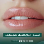 أفضل أنواع الفيلر للشفايف في مركز الطبابة