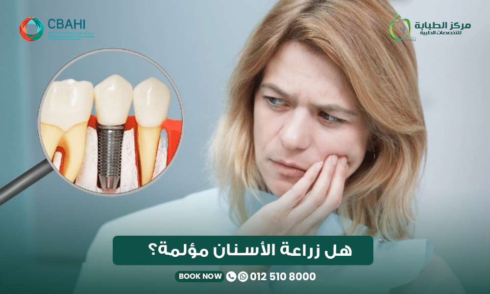 هل زراعة الأسنان مؤلمة؟