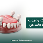 مميزات وعيوب زراعة الأسنان