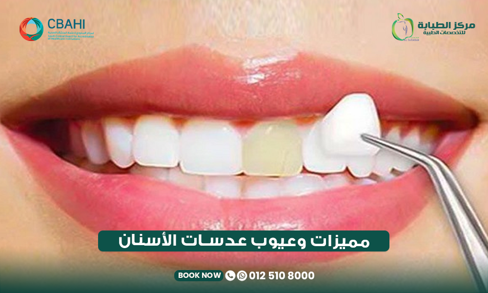 مميزات وعيوب عدسات الأسنان