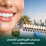 عدسات الإيماكس للأسنان في مركز الطبابة