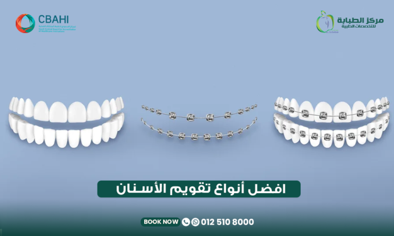 أفضل أنواع تقويم الأسنان