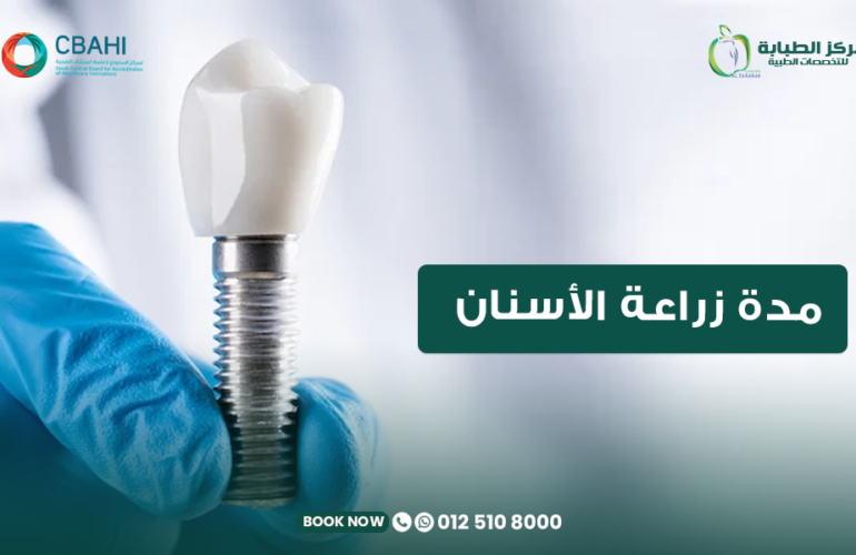 مدة زراعة الأسنان