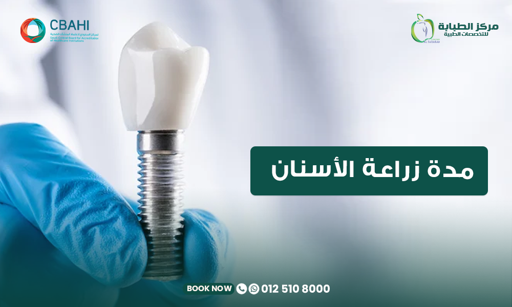مدة زراعة الأسنان: كم تستغرق من البداية حتى تركيب السن النهائي؟ 22 مدة زراعة الأسنان