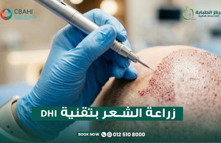 زراعة الشعر بتقنية DHI واقلام تشوي