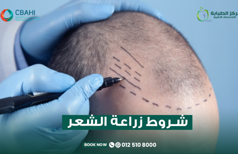 شروط زراعة الشعر