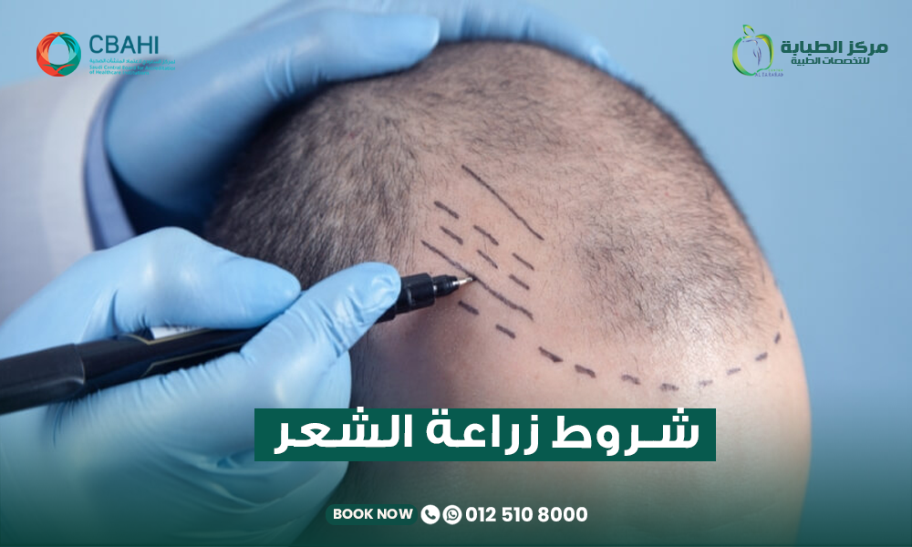 شروط زراعة الشعر