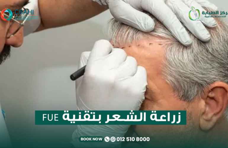 زراعة الشعر بتقنيةfue