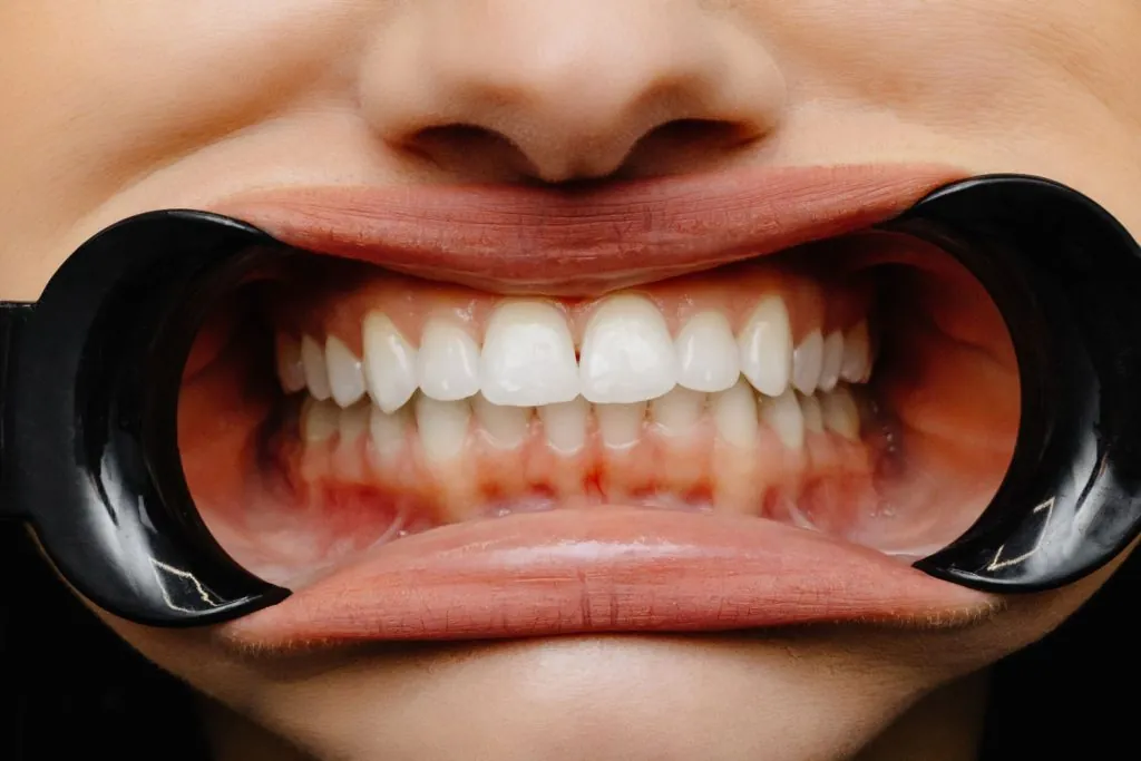 close up of woman cavity protected by retractor sh 2026 03 19 08 14 06 utc