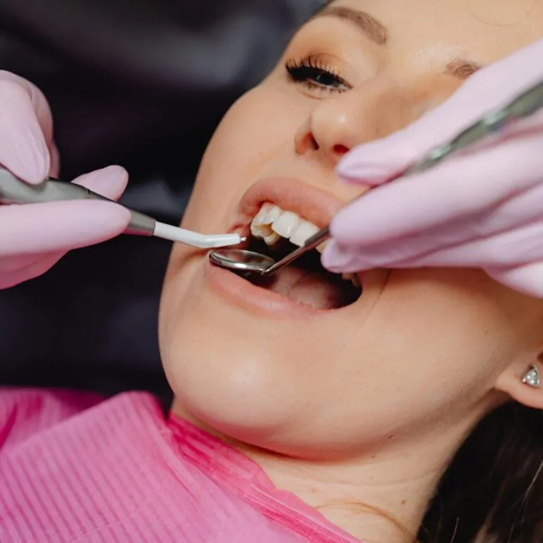 افضل دكتور تجميل اسنان في جدة 8 dental beauty