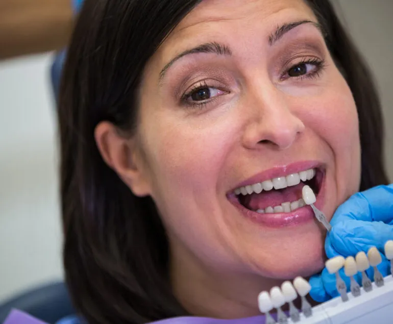 dental bridge