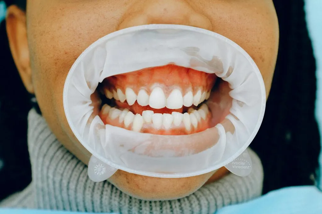 dental white