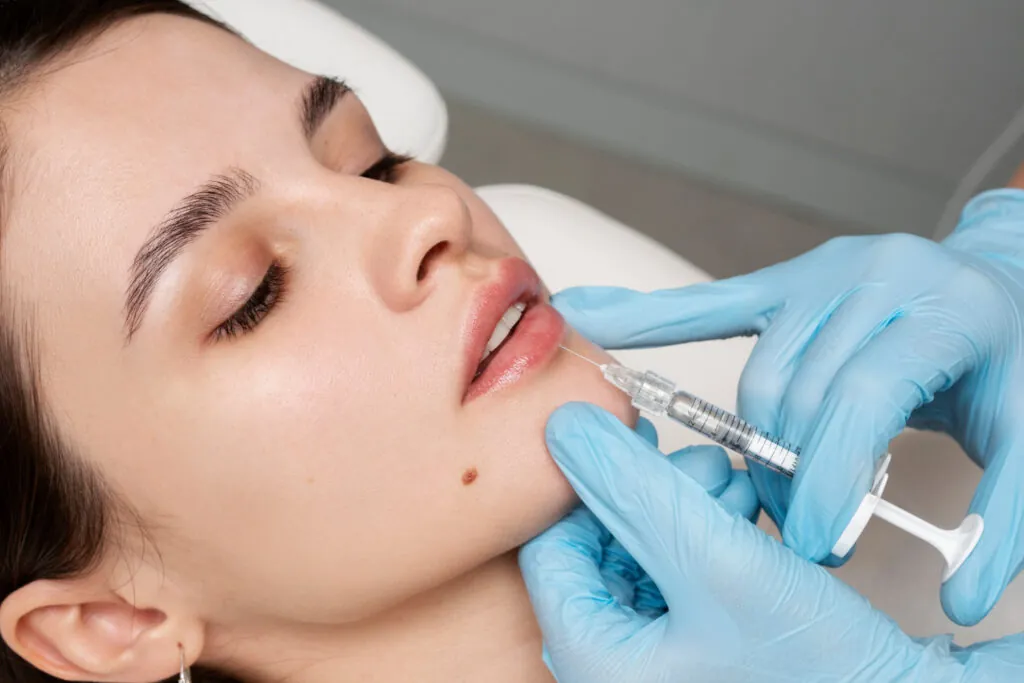 derma filler