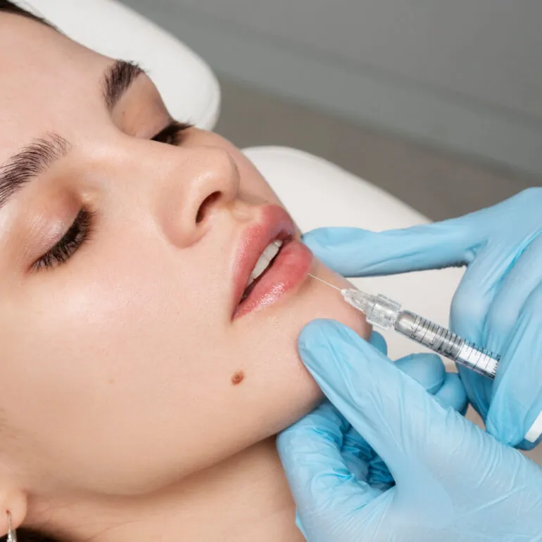 دكتور حقن فيلر في جدة 10 derma filler