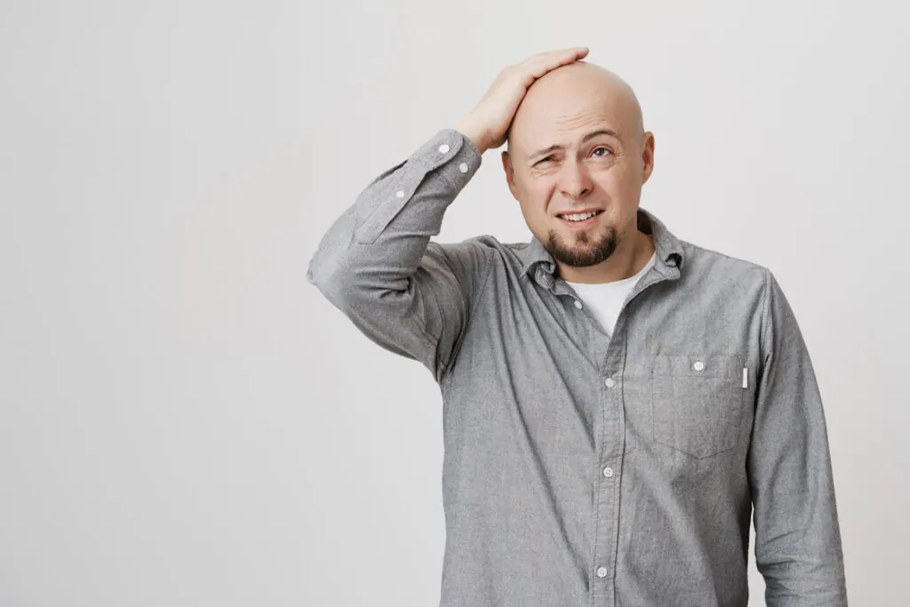 derma hairloss