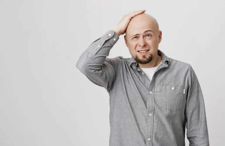 derma hairloss