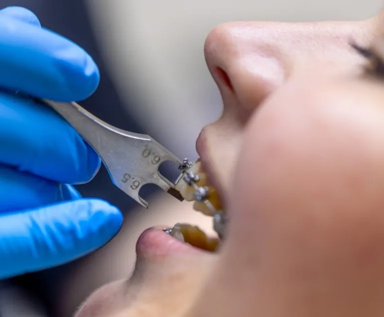 orthodontic 2