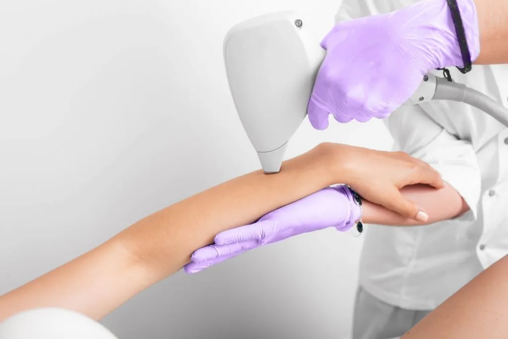 woman getting laser epilation hair removal on han 2026 01 08 23 31 21 utc 1