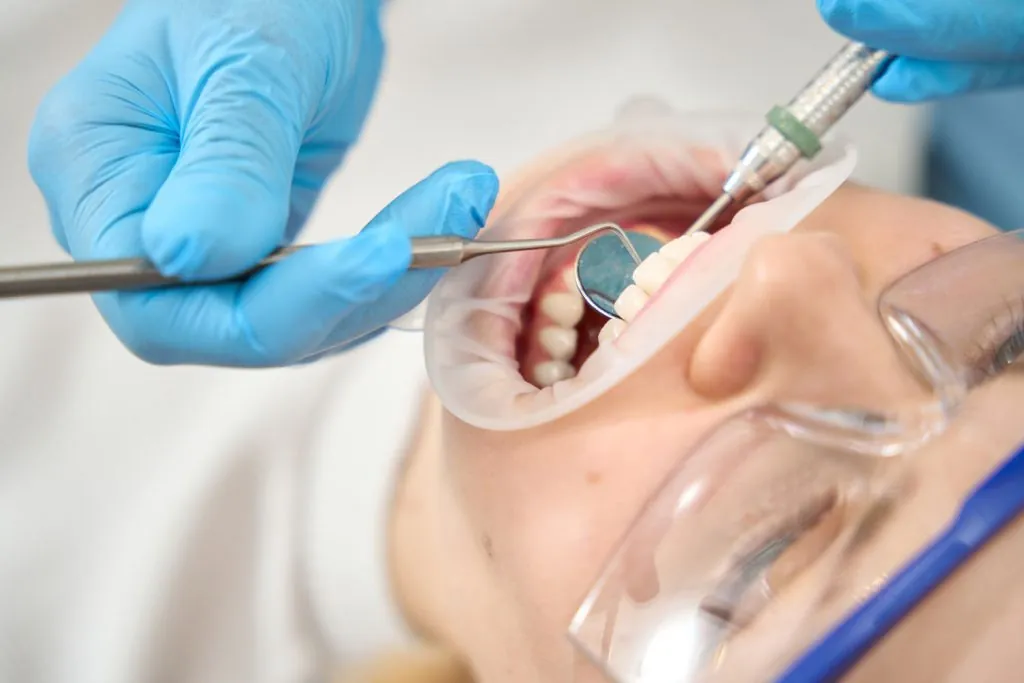 close up of dental treatment for young woman in de 2026 03 10 04 50 12 utc