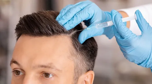 تقنية حقن الميزوثيرابي للشعر