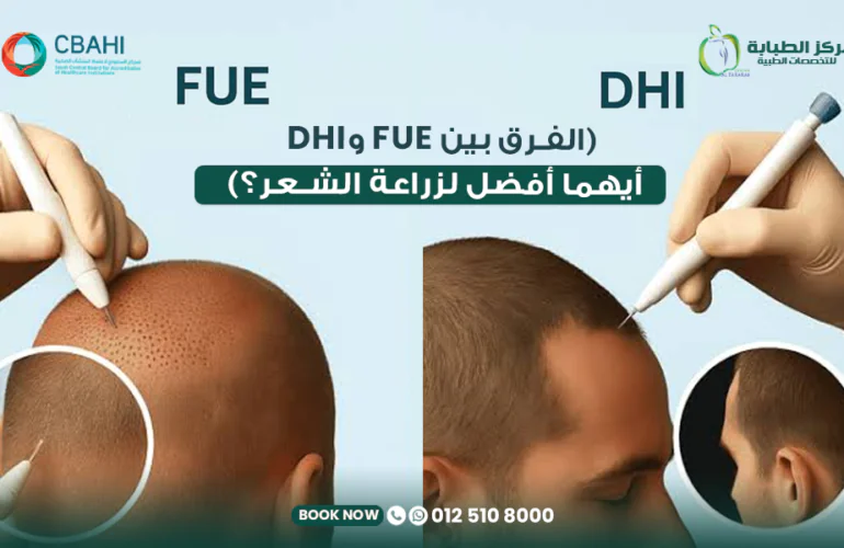 الفرق بين زراعة الشعر بتقنية FUE وDHI