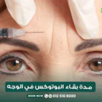 مدة بقاء البوتوكس في الوجه