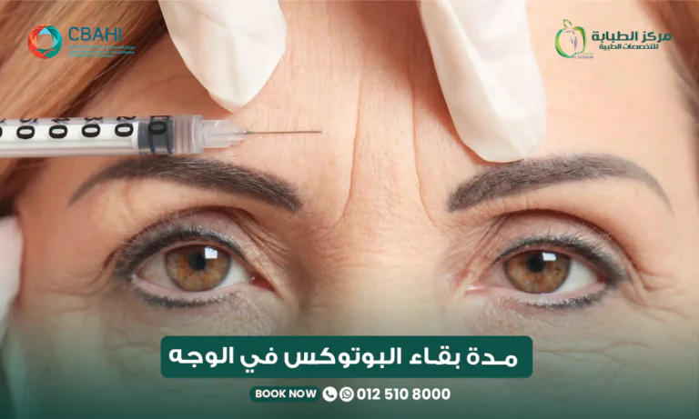 مدة بقاء البوتوكس في الوجه