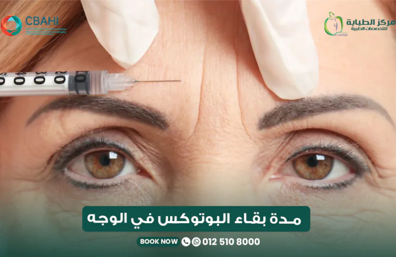 مدة بقاء البوتوكس في الوجه