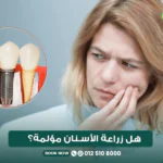 هل زراعة الأسنان مؤلمة؟