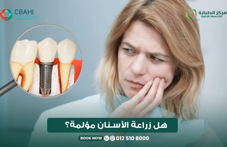 هل زراعة الأسنان مؤلمة؟