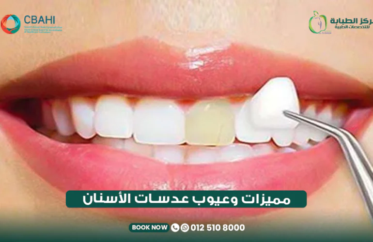 مميزات وعيوب عدسات الأسنان
