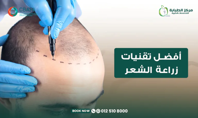 أفضل تقنيات زراعة الشعر