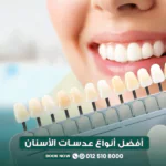 أفضل أنواع عدسات الأسنان