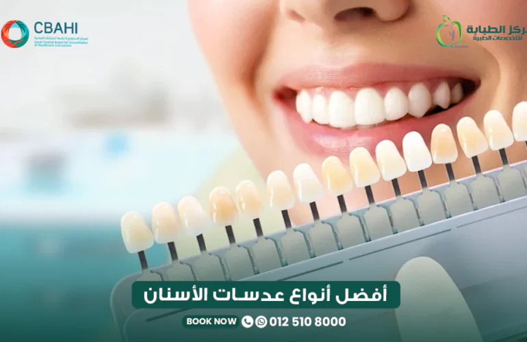 أفضل أنواع عدسات الأسنان