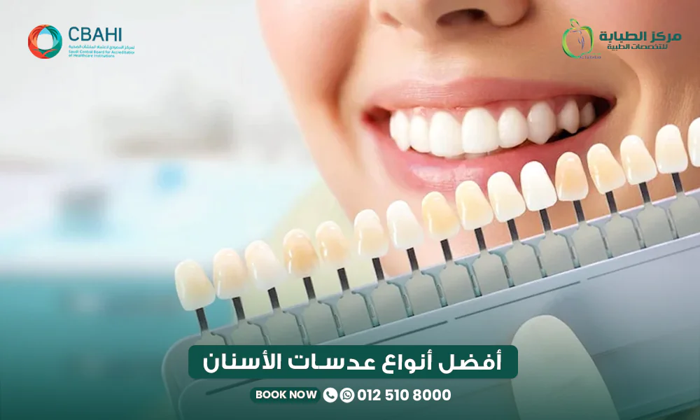 أفضل أنواع عدسات الأسنان: مقارنة بين E-max واللومينير والكومبوزيت والفينير 22 أفضل أنواع عدسات الأسنان