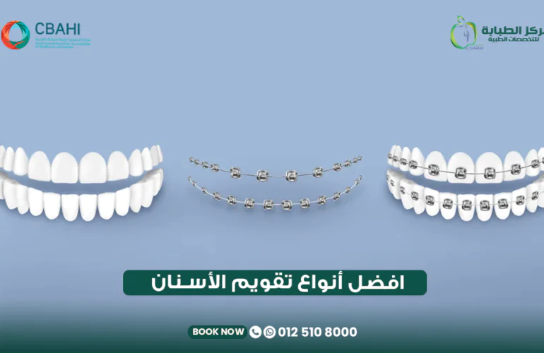 أفضل أنواع تقويم الأسنان