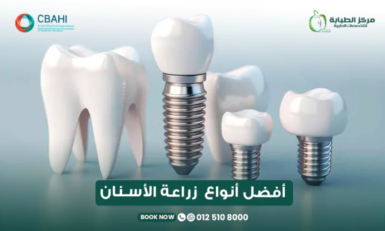 أفضل أنواع زراعة الأسنان