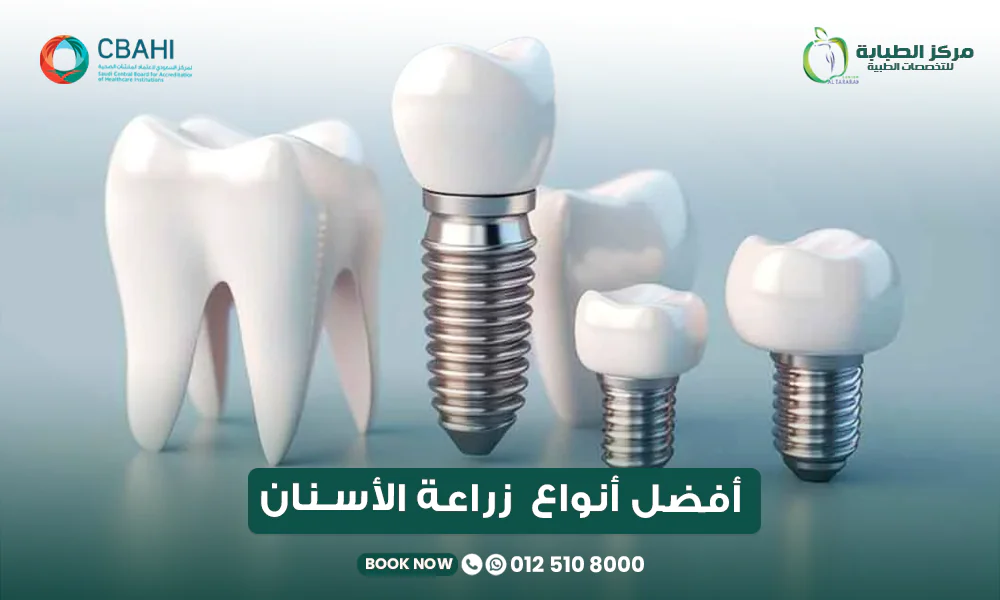 أفضل أنواع زراعة الأسنان: مقارنة بين أشهر الماركات العالمية وكيف تختار الأنسب؟ 22 أفضل أنواع زراعة الأسنان