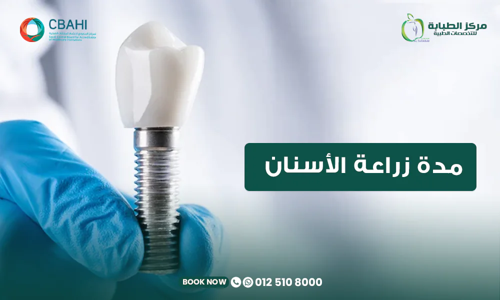 مدة زراعة الأسنان: كم تستغرق من البداية حتى تركيب السن النهائي؟ 22 مدة زراعة الأسنان