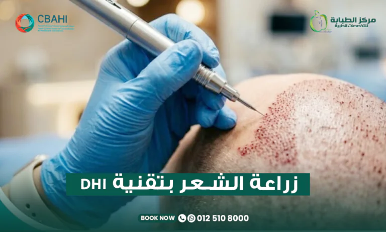 زراعة الشعر بتقنية DHI واقلام تشوي