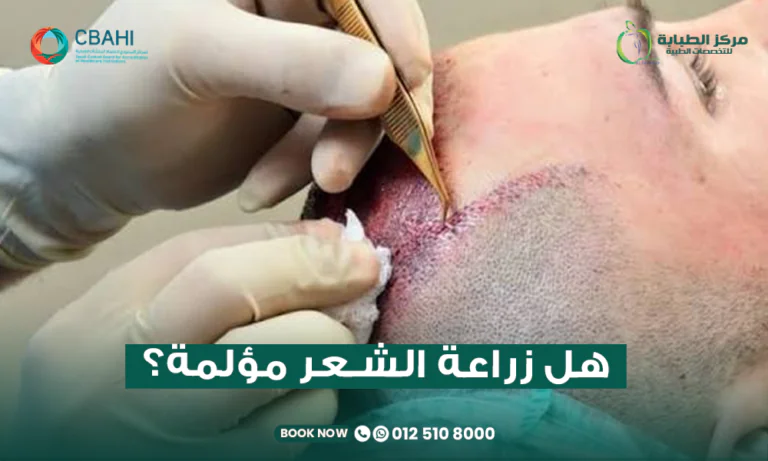 هل زراعة الشعر مؤلمة