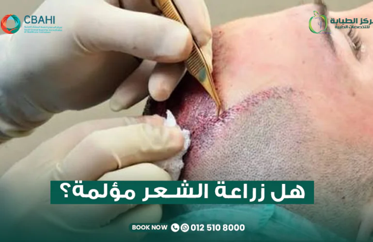 هل زراعة الشعر مؤلمة؟ الحقيقة الكاملة أثناء وبعد العملية ومدة الألم 23 هل زراعة الشعر مؤلمة