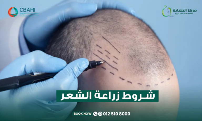 شروط زراعة الشعر