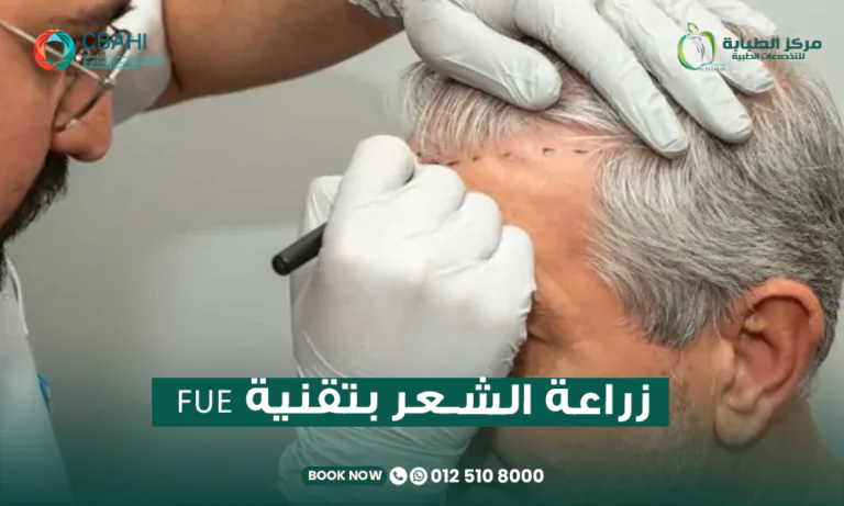 زراعة الشعر بتقنيةfue